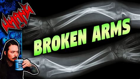 <b>broken arms reddit full story</b> iq fo Nov 17, 2022 · After the former One Direction bandmate broke his armon 12 November, he assured fans he is doing well. . Broken arms reddit full story